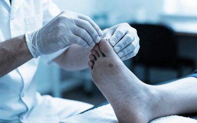 علاج غرغرينا القدم السكرى