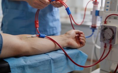 عمل الوصلات الوريدية الشريانية وقساطر الغسيل الكلوي