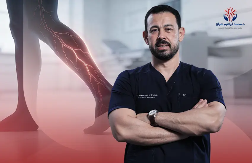 افضل-دكتور-دوالي-الساقين-في-مصر أفضل دكتور دوالي الساقين