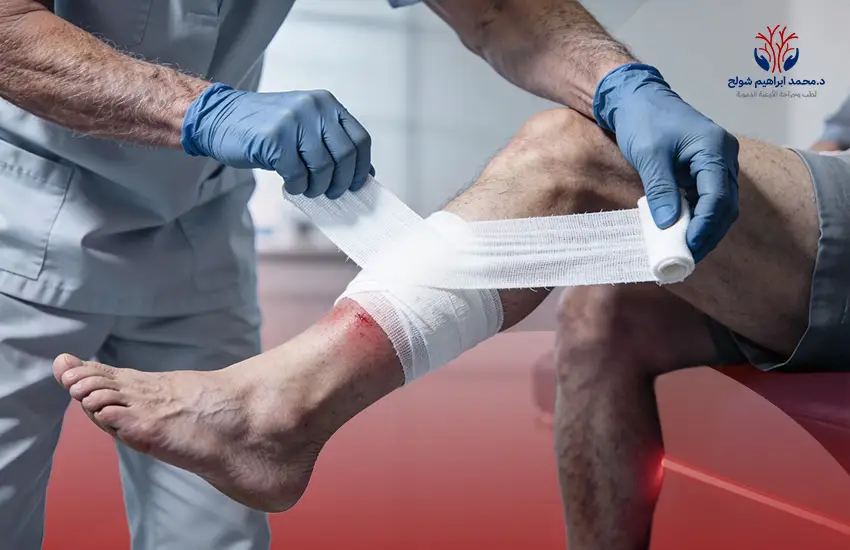 علاج القرح الوريدية