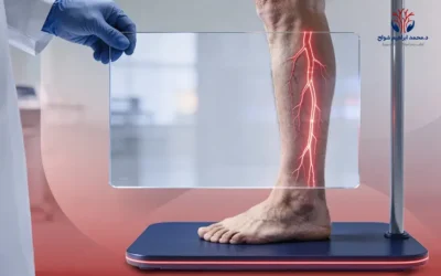 تعرف إلى وسائل تشخيص و علاج جلطة الساق