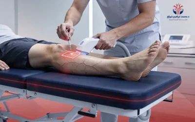 علاج دوالي الساقين بتقنية الكلاكس