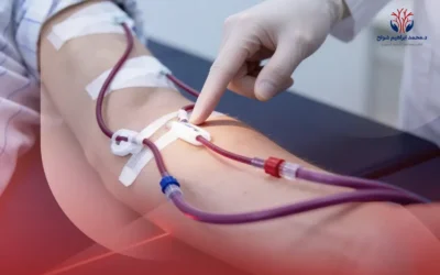 ما هي طريقة تركيب قسطرة الغسيل الكلوي؟