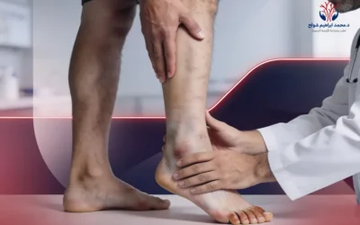 أعراض ضعف الدورة الدموية